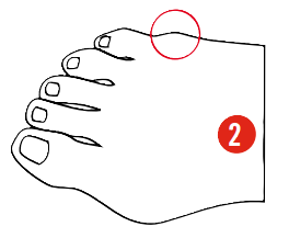Targeted shell and zone molding to widen the ski boot and relieve little toe bunion pressure for Oshkosh area skiers.