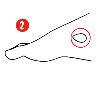 
Targeted shell and zone molding to reshape the boot and relieve pressure on the inside of the ankle for Oshkosh skiers.